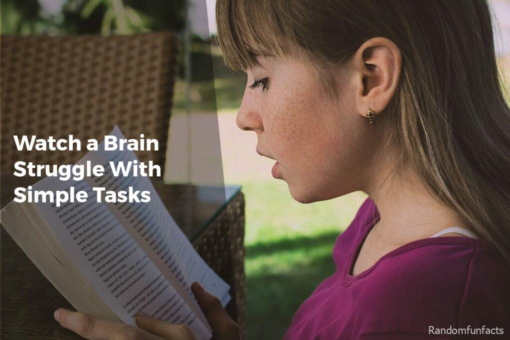 Watch a Brain Struggle With Simple Tasks - Facts