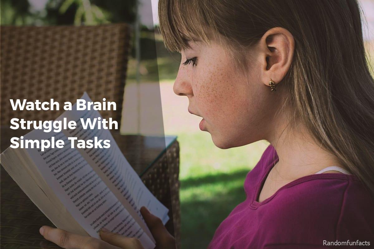 Watch a Brain Struggle With Simple Tasks - Facts